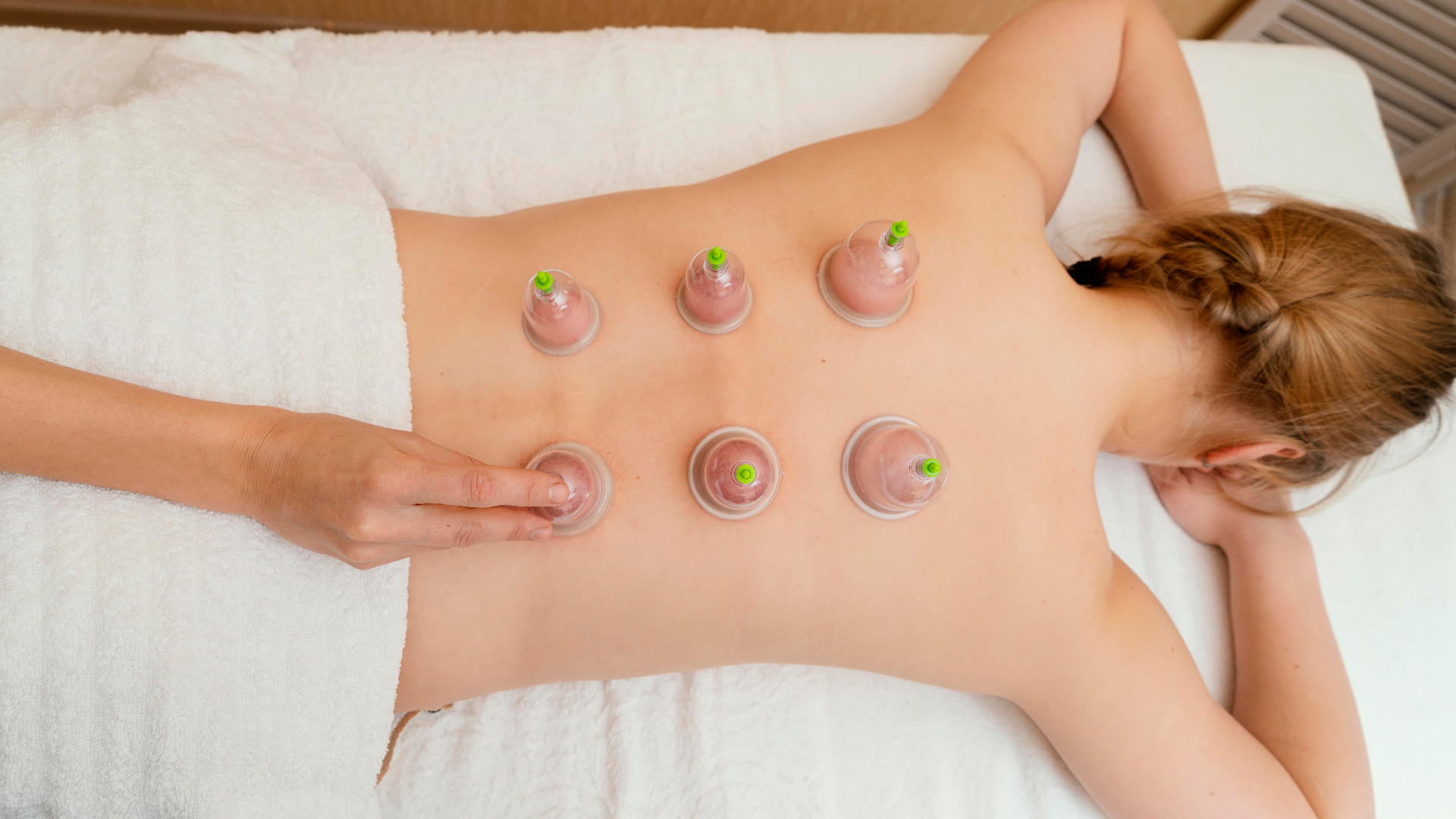 Cupping